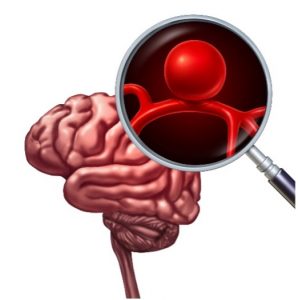 מפרצת מוחית